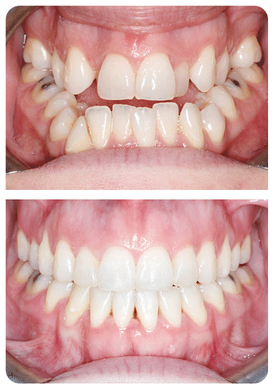 Orthodontist Toronto ON