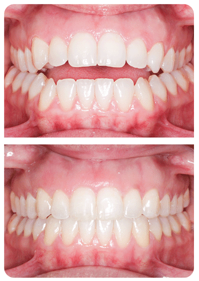 Perfect Orthodontic Solution