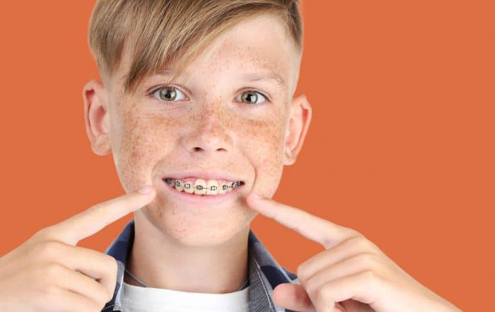 When Should I Take My Child to the Orthodontist