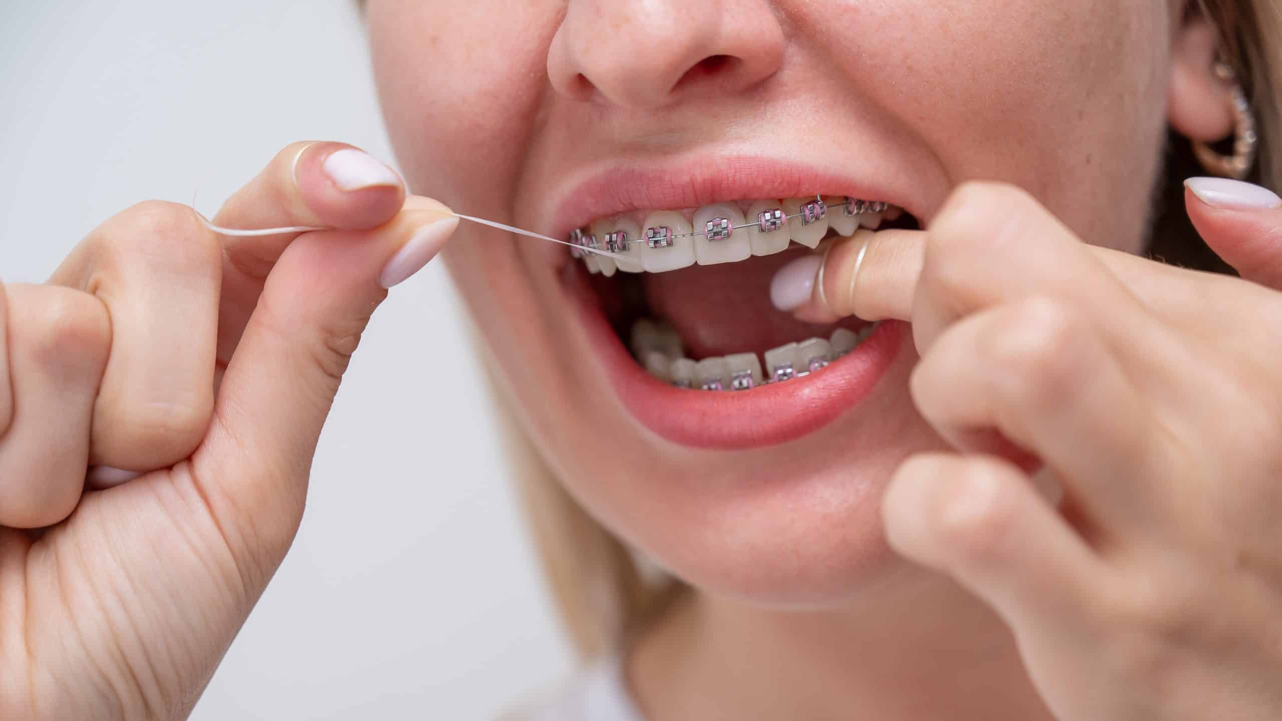 Flossing also helps prevent gum disease