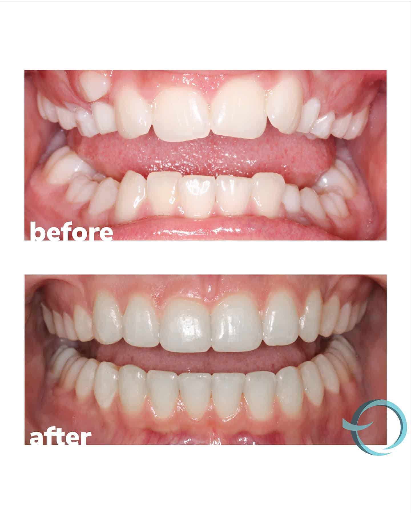 orthodontist before and after
