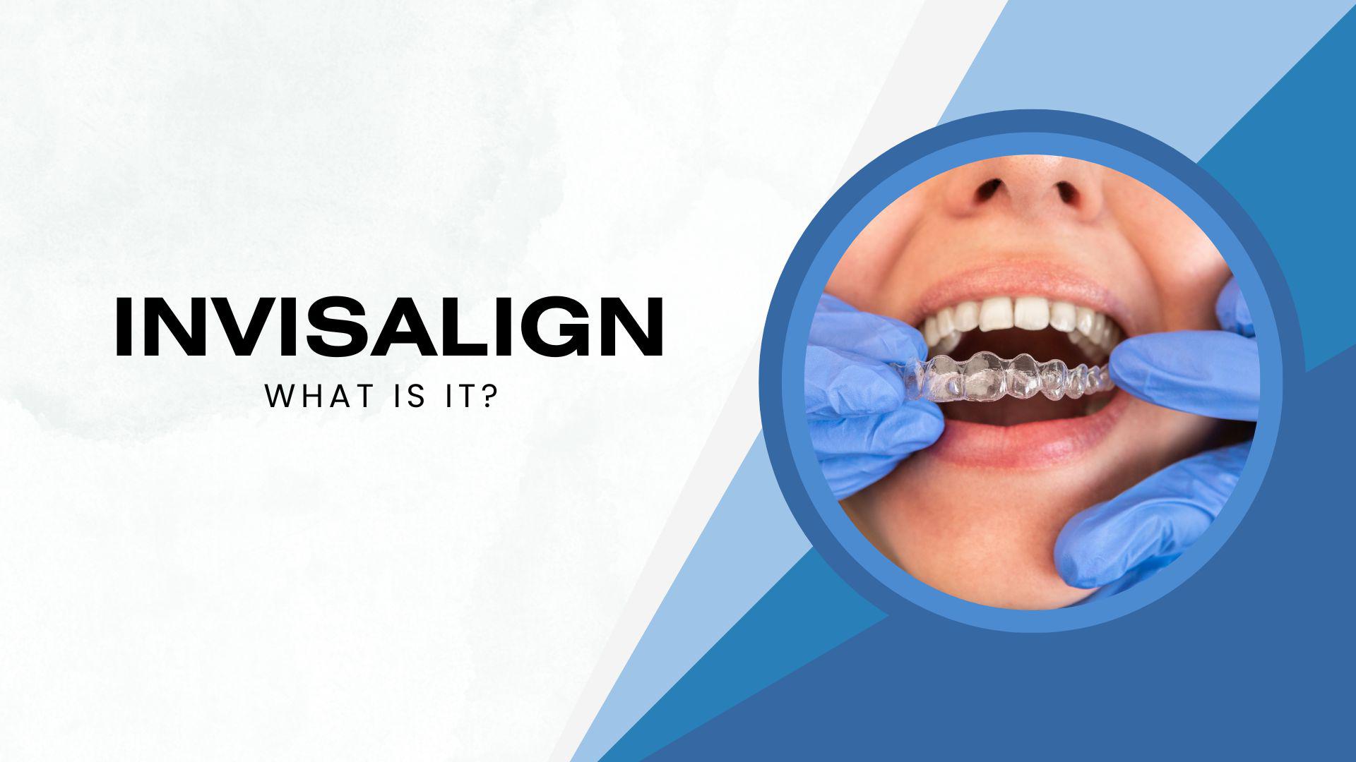 What is Invisalign?